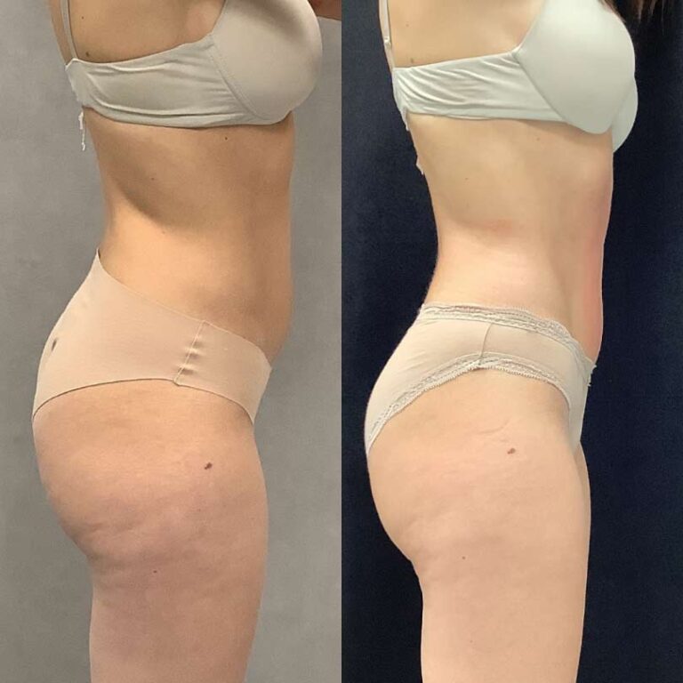 pre-post-1