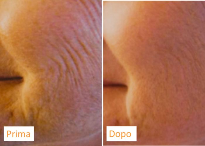 Bio viso 2
