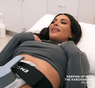 Kim-K-Emsculpt-Copyright-E-Channel