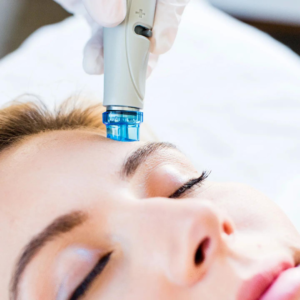 Pulizia del viso con Hydrafacial