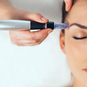 MicroNeedling SkinPen
